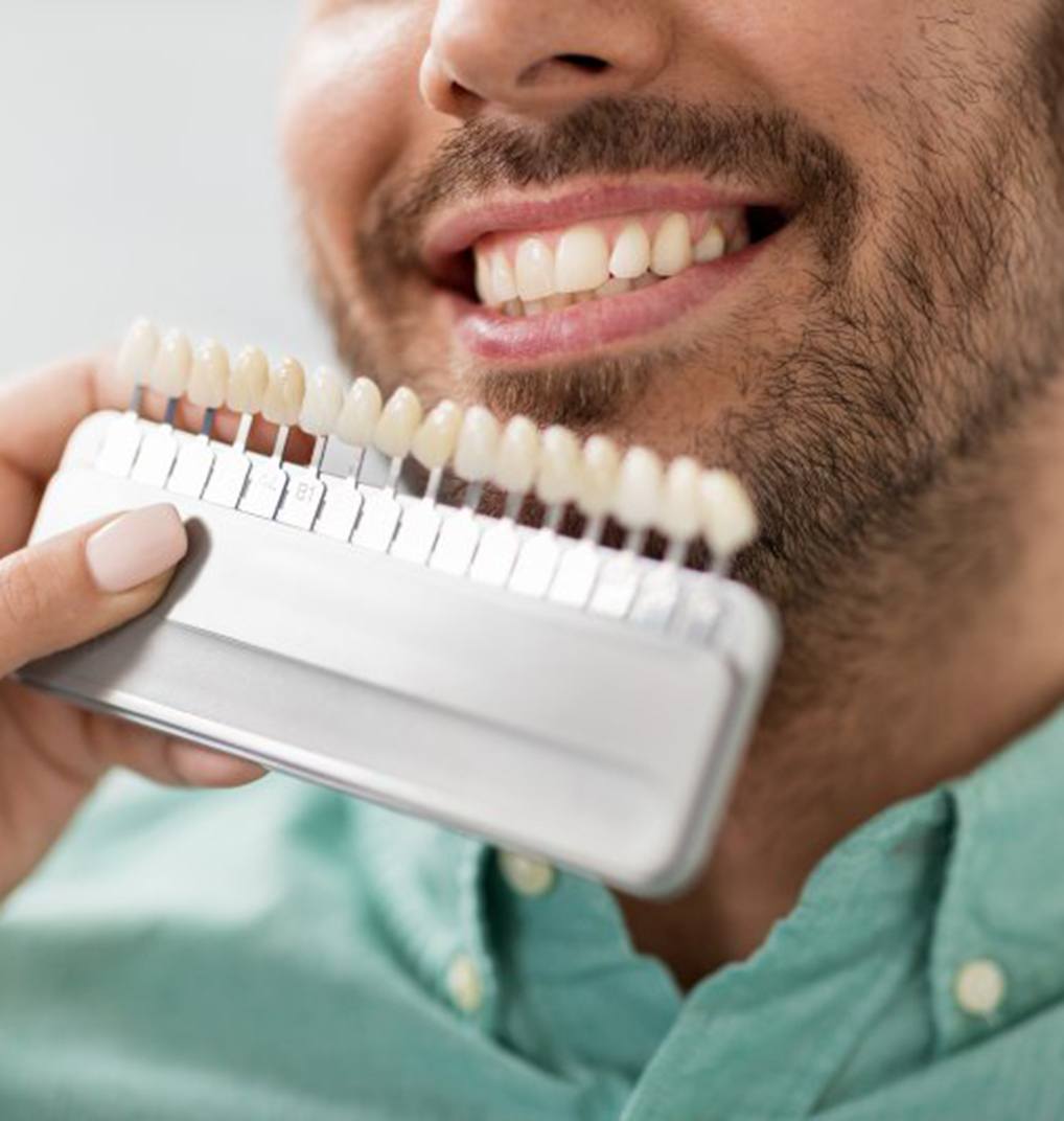 Dentist color-matching veneers to patient’s smile